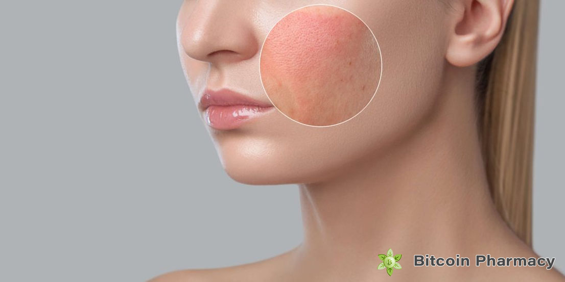 Why Is Your Face Red and Itchy?